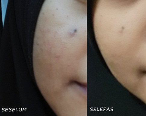 Ephyra Skin Care Series