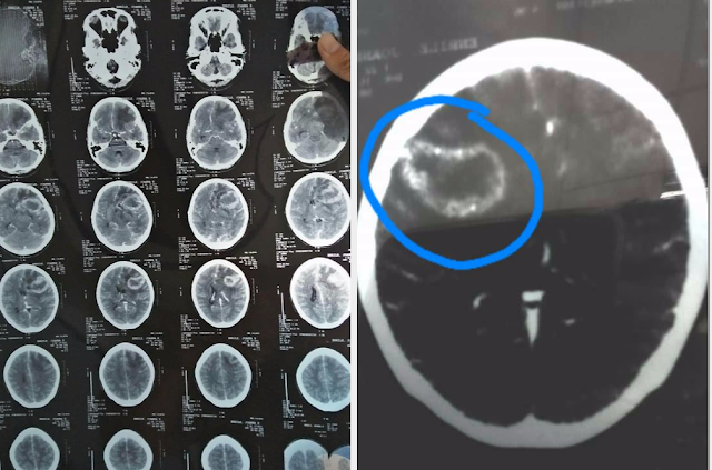 GIRL GETS SICK AFTER EATING THIS TYPE OF FOODS! GIRL GETS SICK AFTER EATING THIS TYPE OF FOODS!