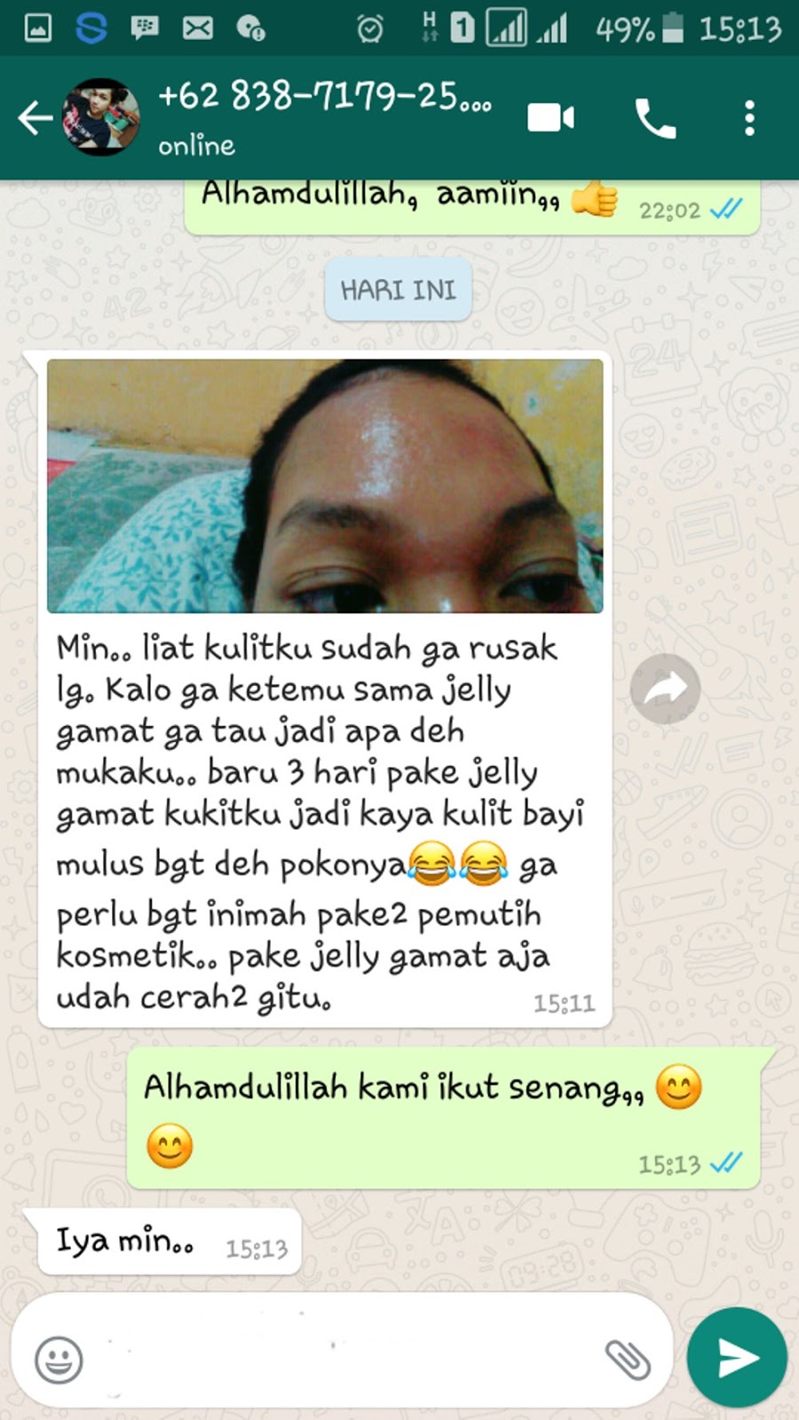 Cara Menghilangkan Jerawat dan Flek Hitam Di Wajah Terbukti Mujarab ~ TESTIMONI QNC JELLY GAMAT Cara Menghilangkan Jerawat dan Flek Hitam Di Wajah Terbukti Mujarab ~ TESTIMONI QNC JELLY GAMAT
