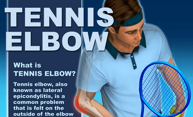 Image: What is Tennis Elbow