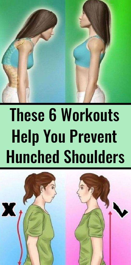 Simple Exercises to Improve Posture and Prevent Hunched Shoulders