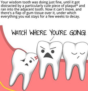 3 Simple Techniques For Wisdom Teeth Signs