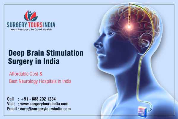 Deep brain stimulation in India