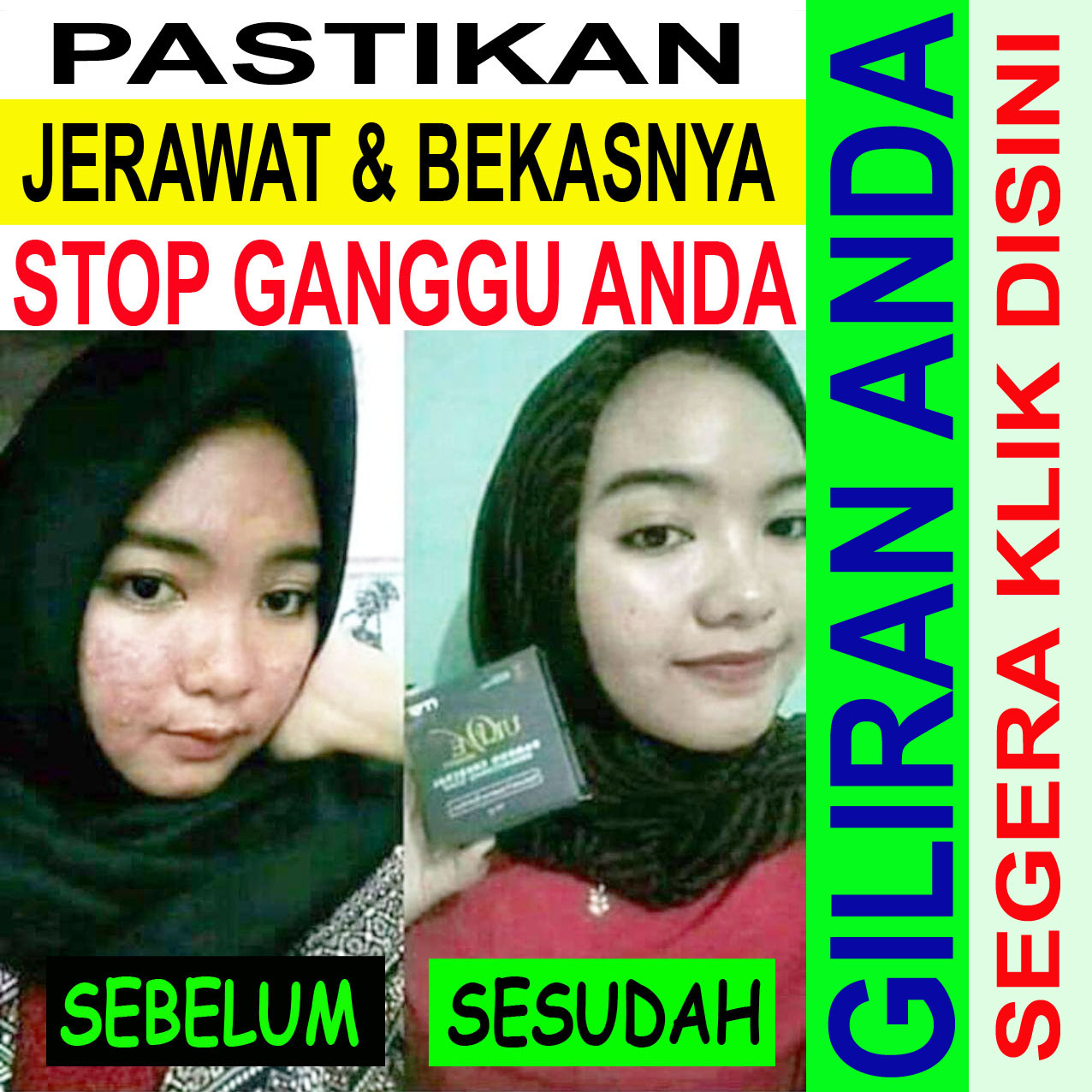 STOP JERAWAT