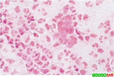 Medical Microbiology - NCBI Bookshelf