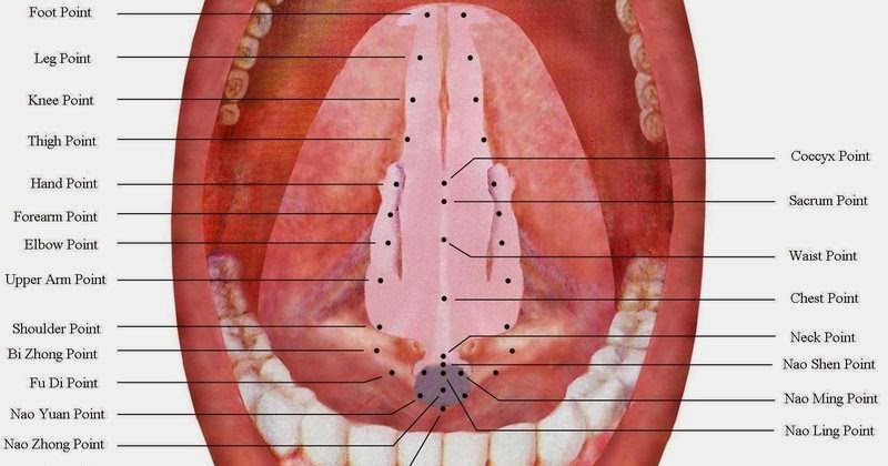 Chinese Medicine Adventures with Damien Bodnarchuk: Acupuncture on the