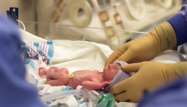 Hindari Kelahiran Prematur, Baca Penyebabnya Berikut Ini