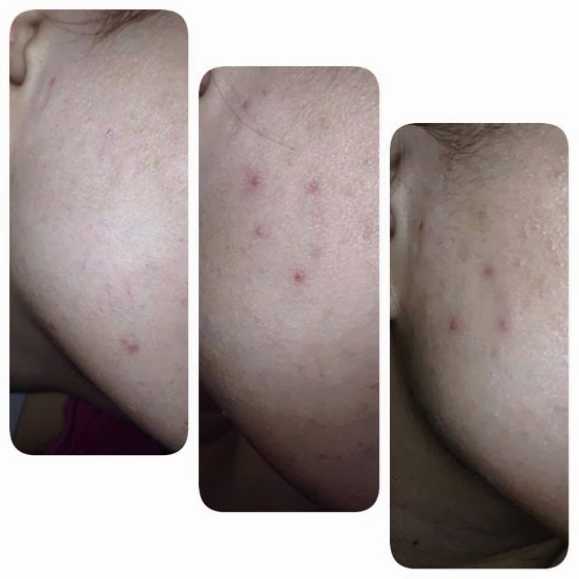 awas buang collagen plus awas buang collagen plus