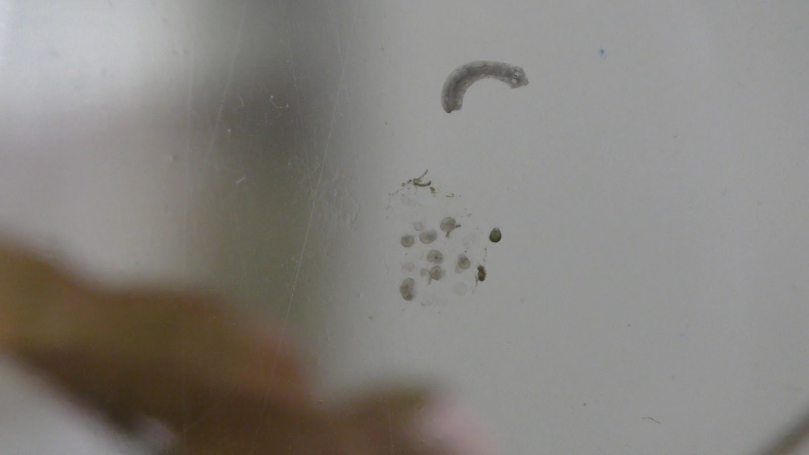 Schwarze würmer im klo