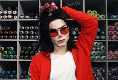 The boy has done 11 times plastic surgery, spent 21 lakhs to look like Michael Jackson