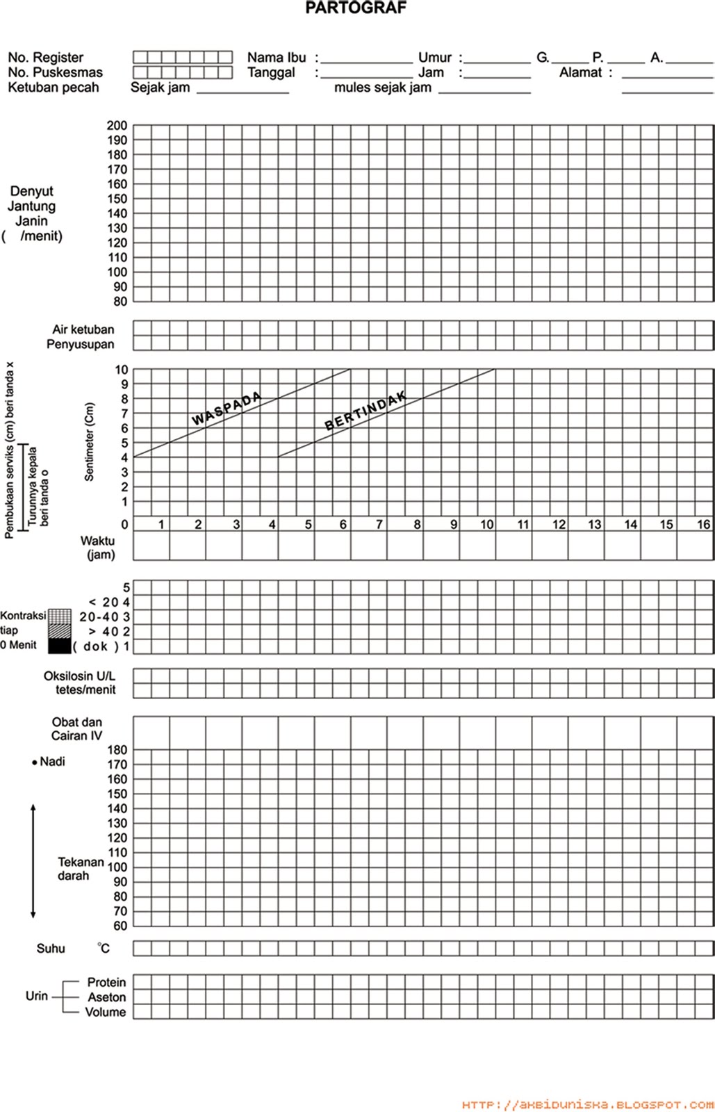 Apa itu Partograf ?  Jurnal Bidan Diah