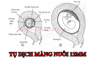 một trường hợp của tụ dịch màng nuôi một trường hợp của tụ dịch màng nuôi