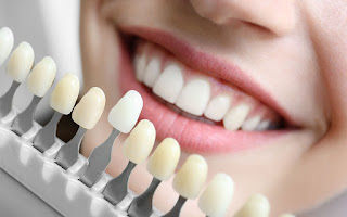 What is tooth color restoration? How tooth colored filling restore your ...