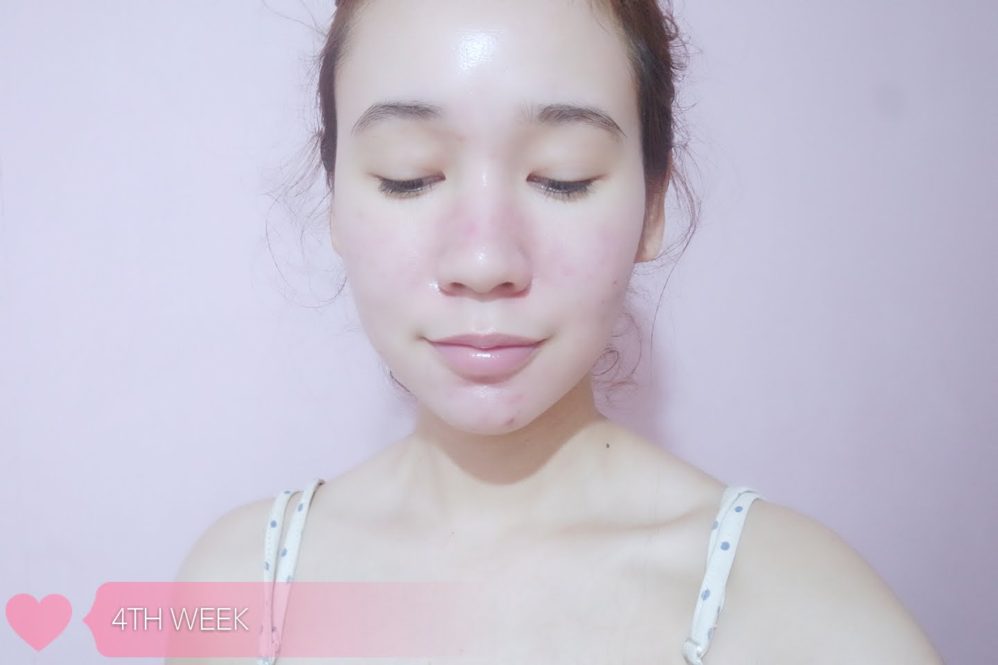 REVIEW(S) Lumice Whitening Oil Serum pinkislovebynix