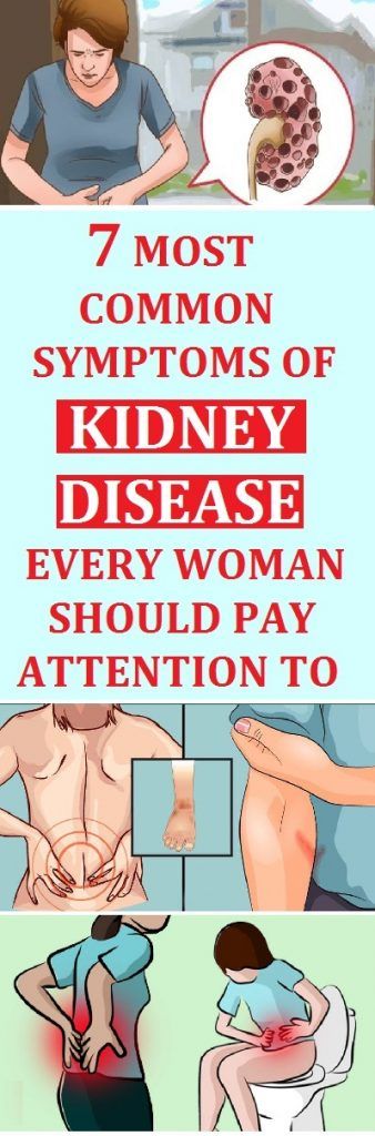 7-most-common-symptoms-of-kidney-disease-every-woman-should-pay