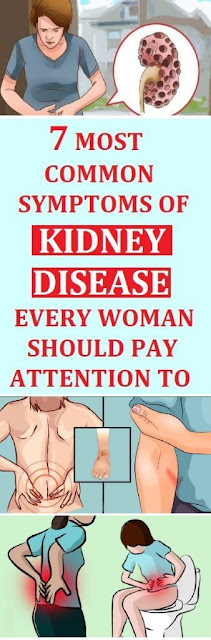 7 Most Common Symptoms of Kidney Disease Every Woman Should Pay Attention To
