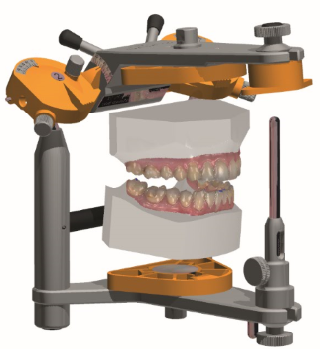 Cad/Cam Technology for the Dental/Orthodontic Specialist: 4Qube, the ...