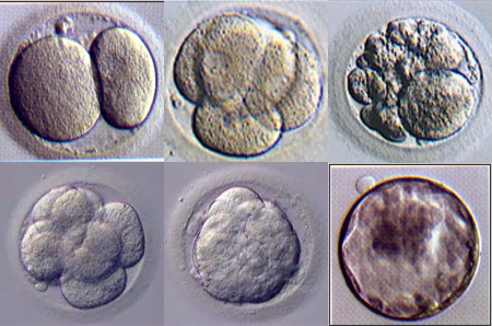 A natureza da vida: Fecundação in Vitro