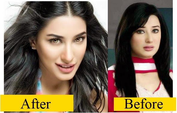 Mehwish+Hayat+Before+And+After+Surgery+picture+3.jpg
