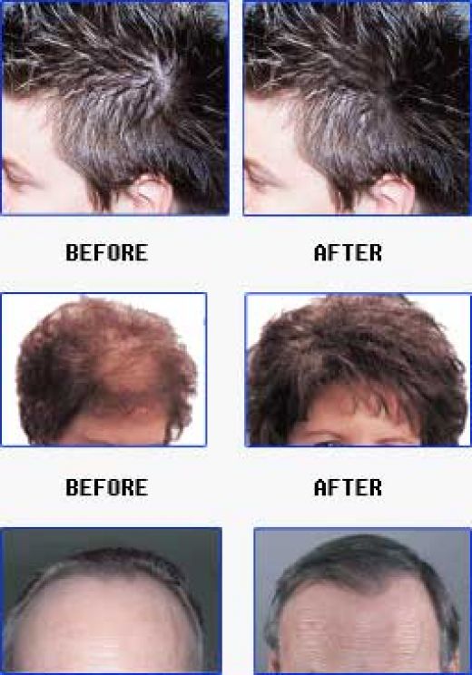 meganosborn: Hair Loss Leave In Conditioner : 6 Causes ...