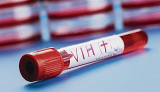 Unicef alerta que cada tres minutos una adolescente contrae el VIH.