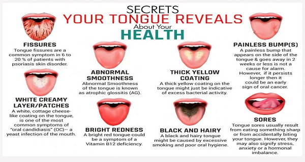 THIS IS WHAT YOUR TONGUE HAS TO SAY ABOUT YOUR HEALTH! - Health And Safety