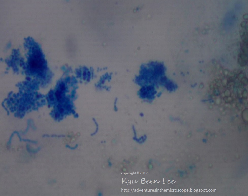 MicroWorld mucus with bacteria