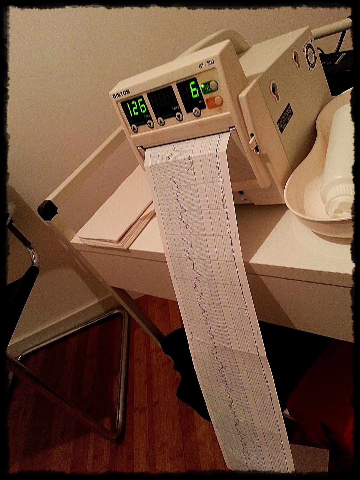 Bilder Zu Wie Sehen Wehen Auf Dem Ctg Aus