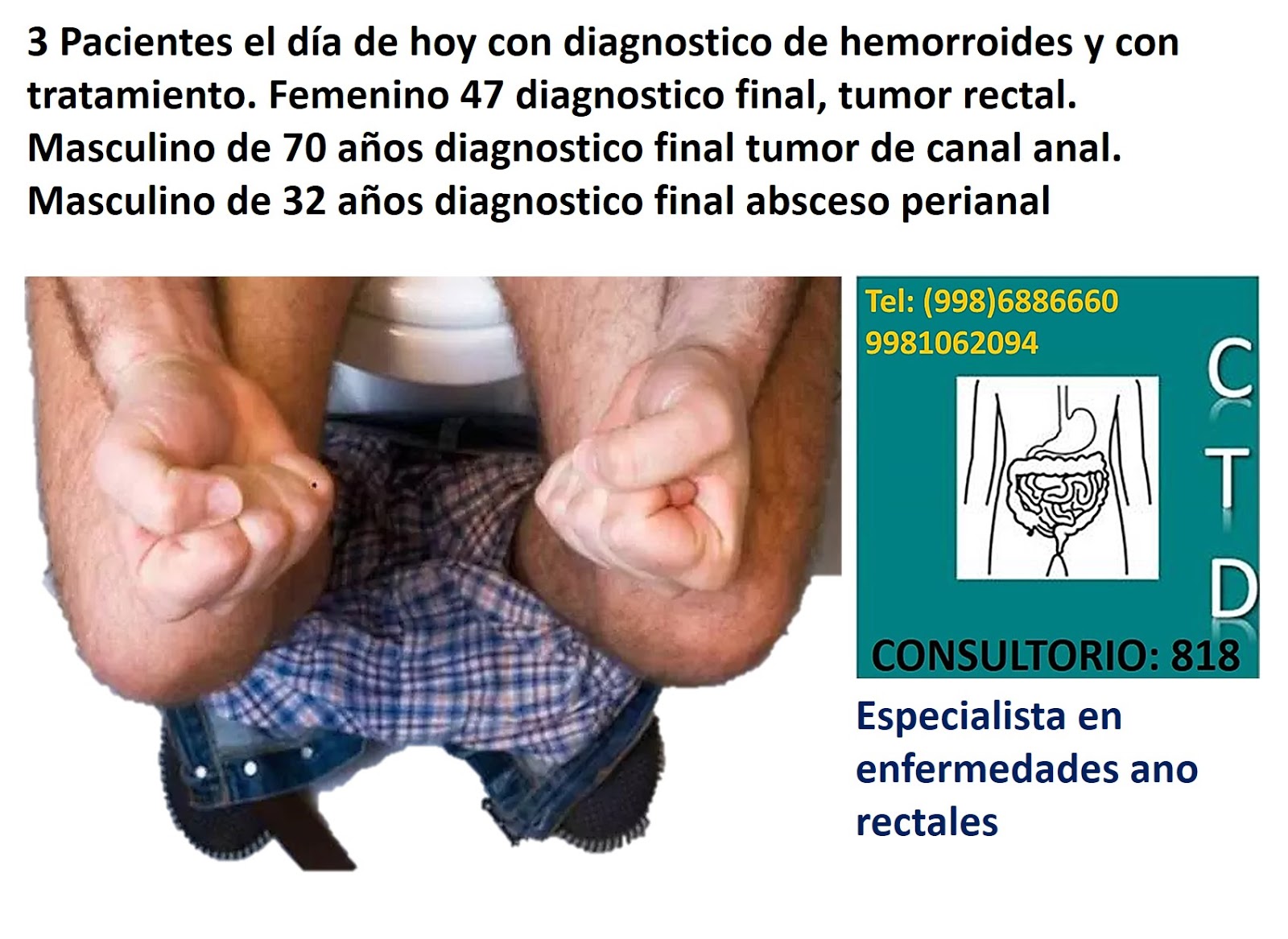 dolor de sacro hemorroides