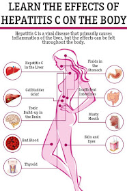 Effect of Hepatitis C on the body