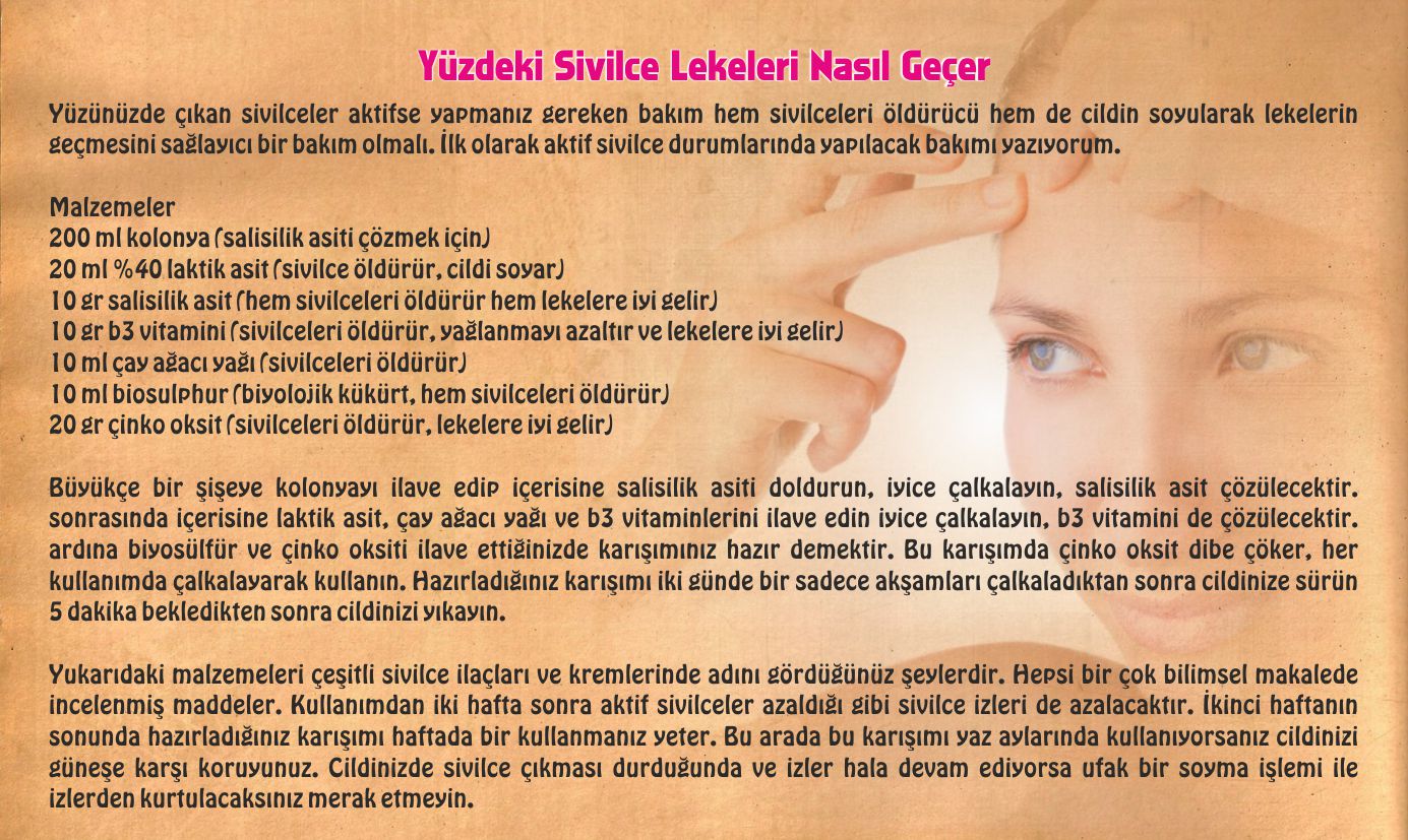 Sivilce İzlerini Ne Giderir: Sivilce İzlerine Bitkisel Çözüm Sivilce İzlerini Ne Giderir: Sivilce İzlerine Bitkisel Çözüm