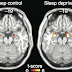 Here's How Lack Of Sleep Changes Your Brain - Doctors Say It's Similar to Torture!