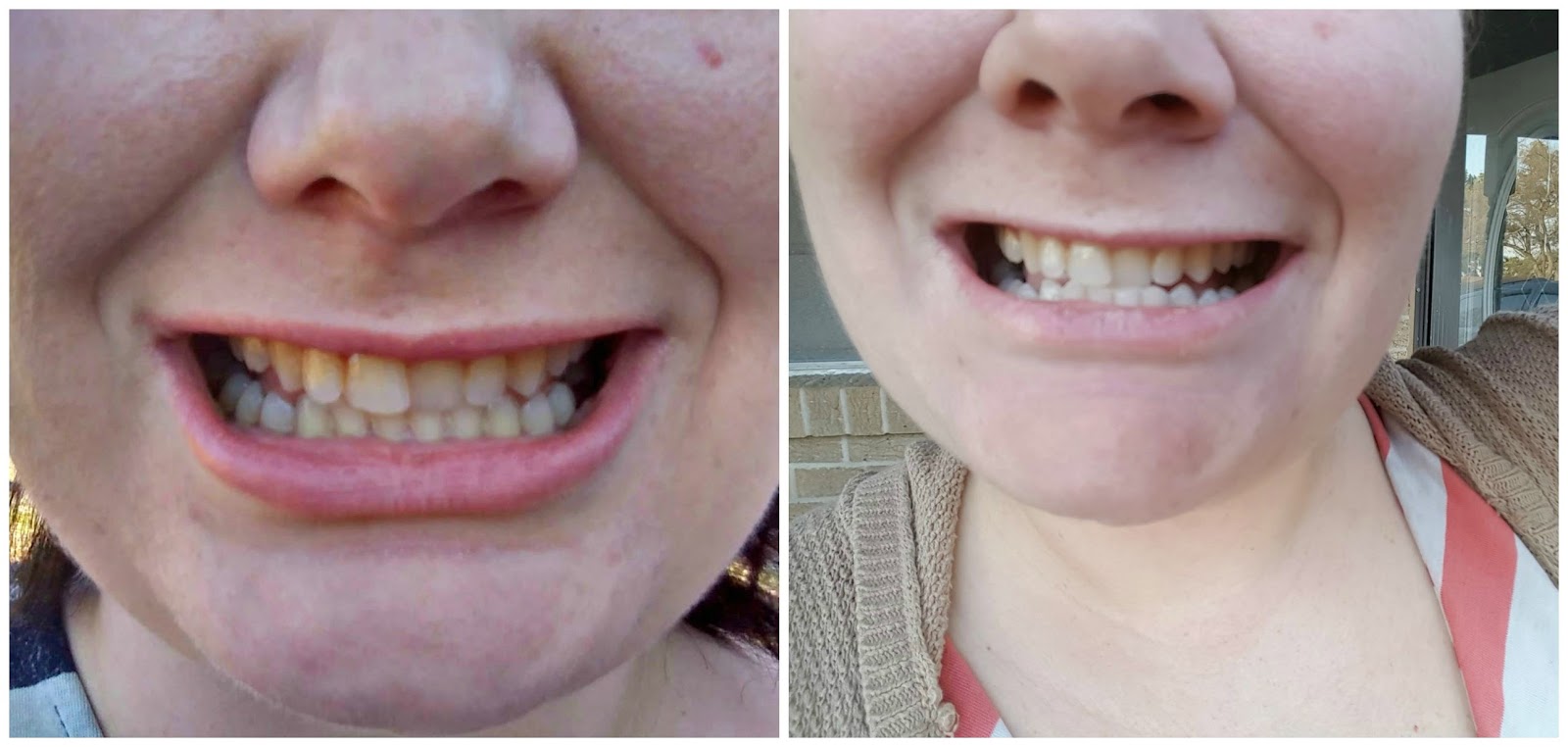 Reviews By Heather Listerine Healthy White anticavity mouthrinse Review!