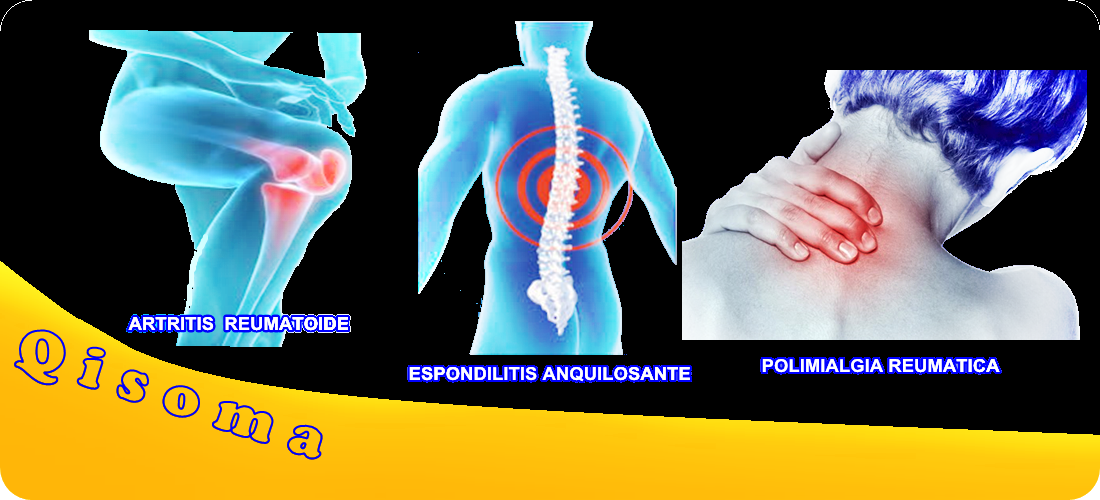 Enfermedades autoinmune de los huesos artritis