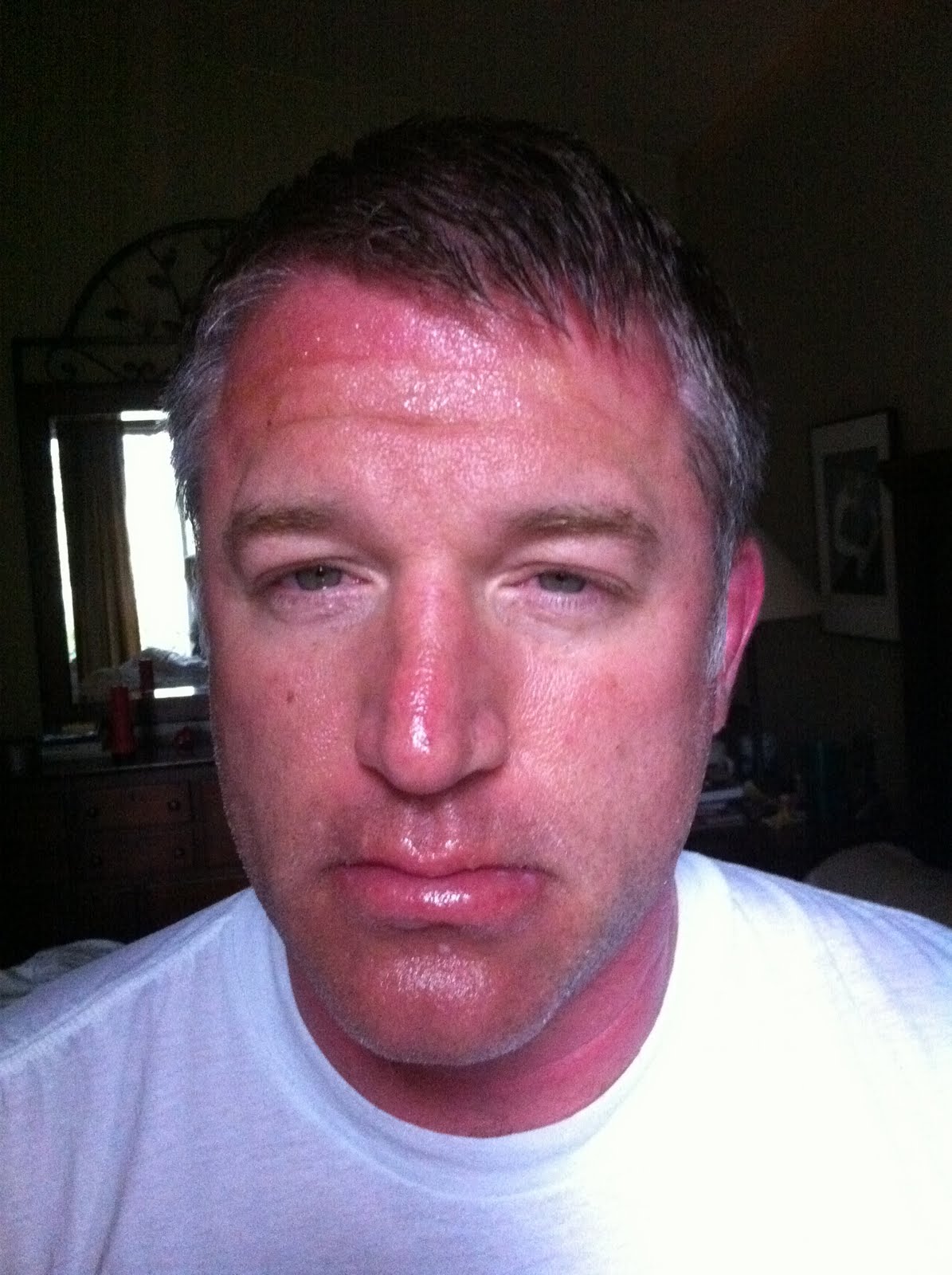 daily cyn Burned faces