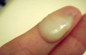 Obat Ampuh Di Apotik Umum Untuk Penis Keluar Nanah Obat Ampuh Di Apotik Umum Untuk Penis Keluar Nanah