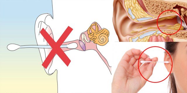 Here Is The Right Way To Remove Earwax From Your Ears, Do Not Make The Same Mistake As Everyone Else