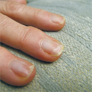 29 Fashion Avenue: Avoid Nail Damage with Proper Gel-Polish Removal