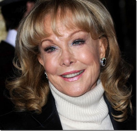 Barbara Eden Plastic Surgery Before and After Nose Job and Facelift Famous Plastic Surgery