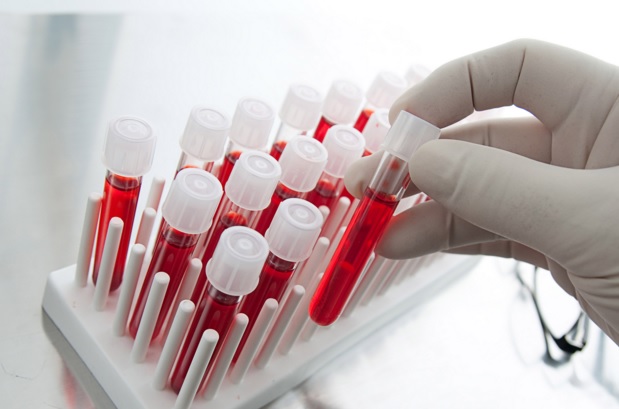 Testi i Gjakut Parashikon se kur Antibiotikët janë të Padobishme 