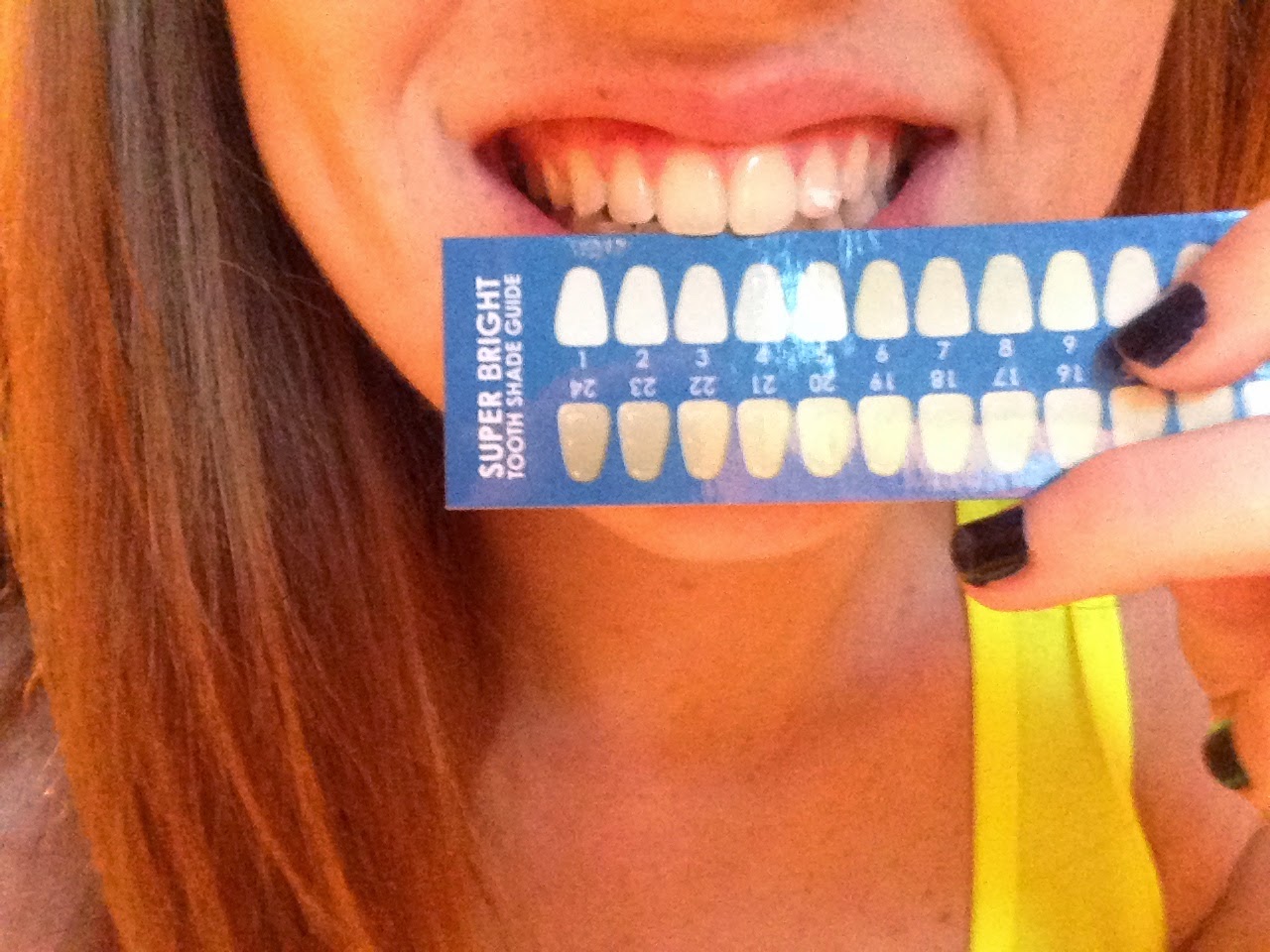 DashingMakeup At Home Teeth Whitening Kit Smile Sciences