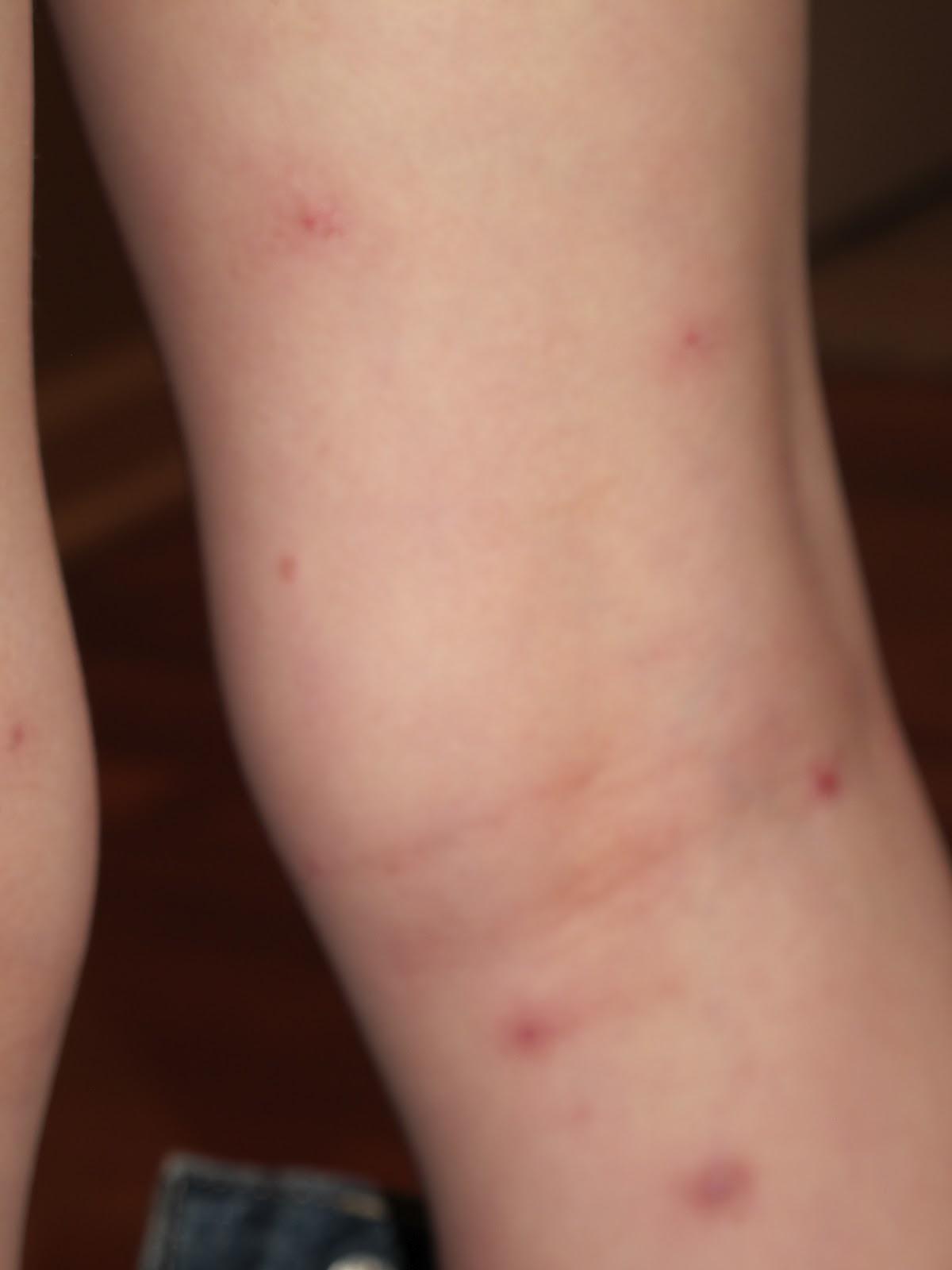 My life...living loving & blogging about it! BED BUGS at The Great