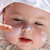 Salep Yang Cocok Untuk Bercak Putih Di Wajah Bayi