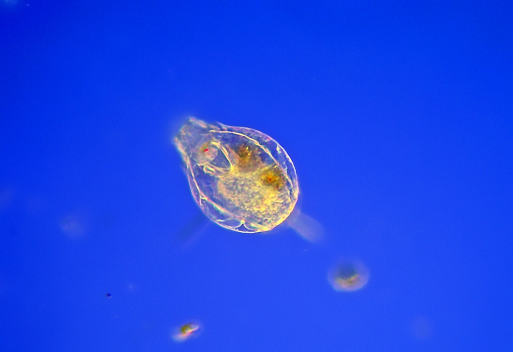 Описание коловратки. Rotatoria коловратки. Коловратки круглые черви. Яйцо коловратки под микроскопом. Коловратка брахионус строение.