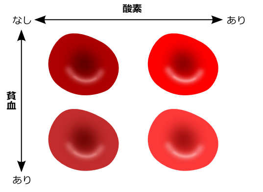 Nhk Bs 美と若さの新常識 増やせ 元気でかわいい赤血球 を見た