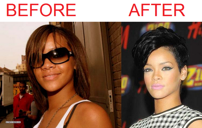 Rihanna Skin Bleaching Before and After