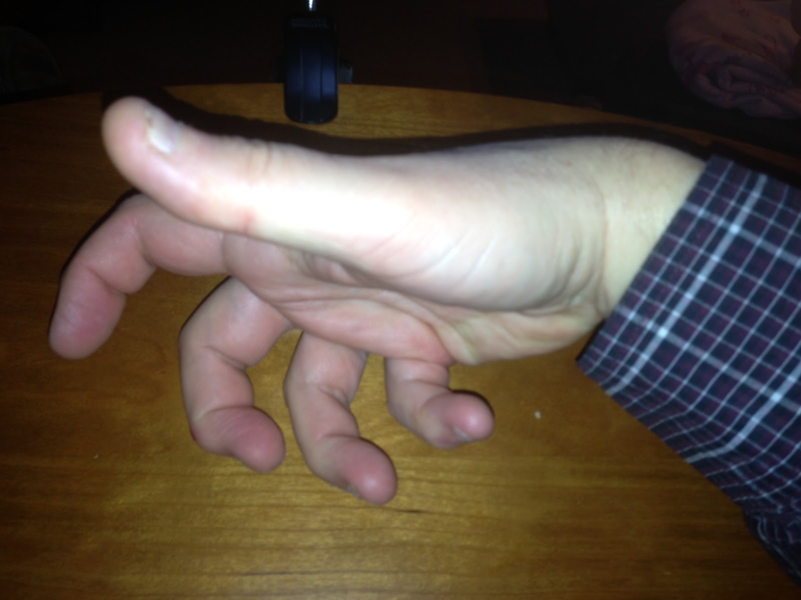 Note Booker, Esq. Medicine for writer's cramp?