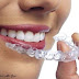أهم الأضرار الناتجة عن تقويم الأسنان