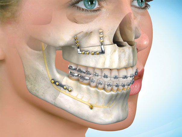 ¿Qué es la cirugía maxilofacial y qué trata?