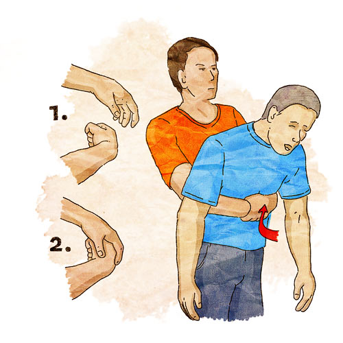 Heimlich Manevrası / Heimlich manevrası tekniğinin sahibi ABD�li dr